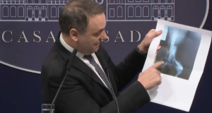 Insólito: Usaron una radiografía de un perro para obtener una pensión discapacidad