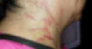 Violencia familiar en el barrio San Ignacio: una mujer de 65 años denuncia agresiones de su hija y ex nuera