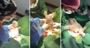 Nacimiento inédito en Salta: trigemelas compartieron una sola placenta