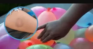 Bombuchazos a motociclistas en Orán: denuncian agresiones en plena vía pública