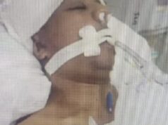 Brutal golpiza en zona sur: un hombre pelea por su vida